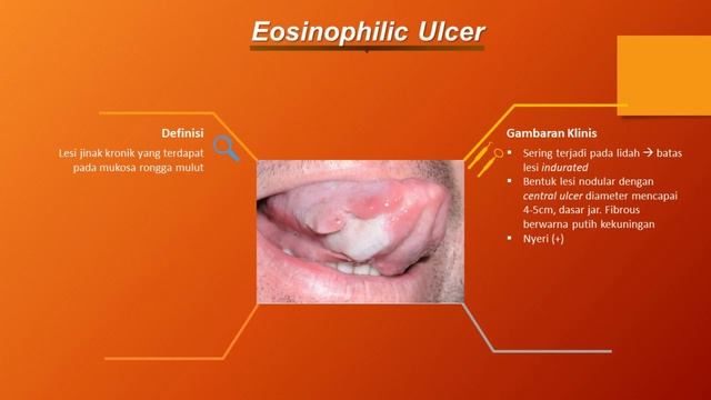 Video Penjelasan 95 Macam Penyakit Mulut (Part 1)