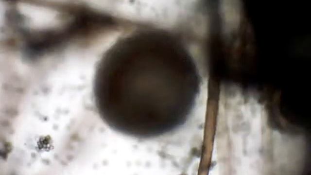morfologia microscopica de aspergillus niger смотреть онлайн