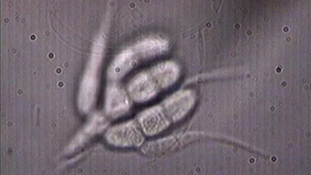 HONGOS DEL PARQUE "EL HAYA" -Tetracladium marchalianum смотреть онлайн