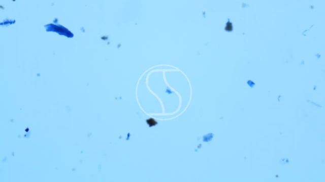 Trichophyton ajelloi under the microscope with Lactophenol Cotton Blue stain смотреть онлайн