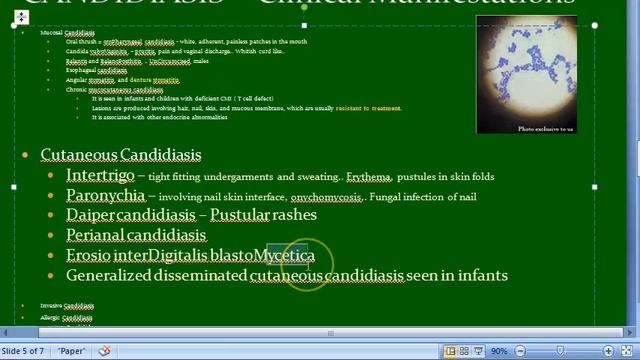 Microbiology 585 b Candida Candidiasis fungus fungi mycosis vulvoVaginitis intertrigo ID reaction смотреть онлайн