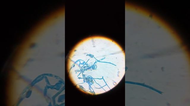 epidermophyton dermatophyte structure, under 45x compound microscope смотреть онлайн