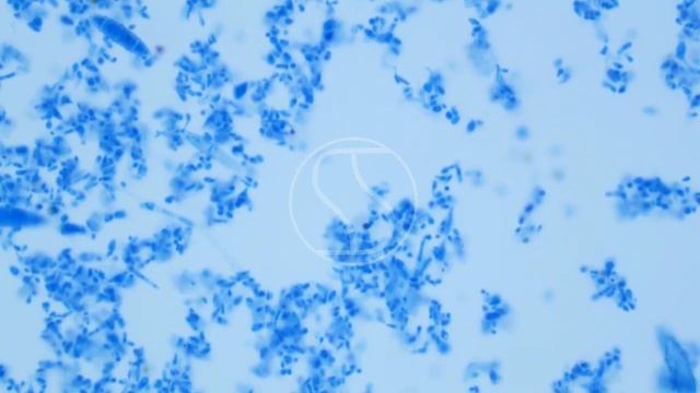 Microsporum gypseum under the microscope with Lactophenol Cotton Blue stain смотреть онлайн