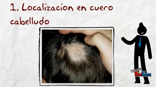 Sintomas De Dermatofitosis