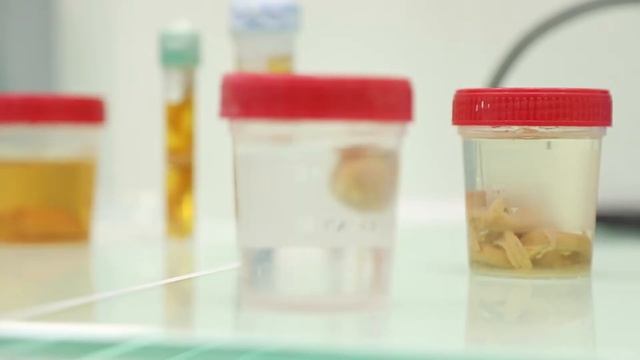 GeliKlotz, a new way for conservation of biological samples in gelled blocks смотреть онлайн