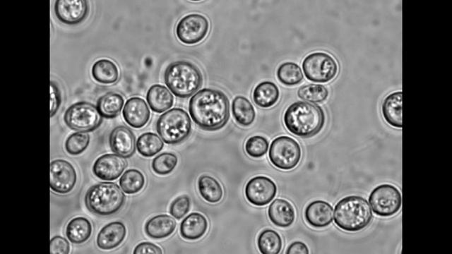 Saccharomyces Boulardii Probiotic Yeast - Digestive Tract Issues, Immunity, Digestion (Yeast)