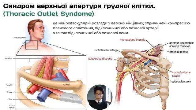 Анатомія хребтового стовпа. Особливості будови хребців. Грудна клітка у цілому. Спинний мозок смотреть онлайн
