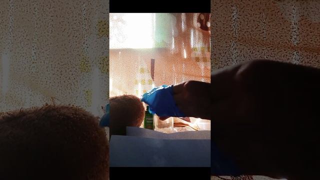 Female Urinary Catheterization (Educational Purposes)