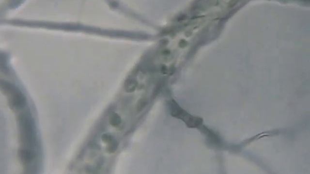 Interaction of Trichoderma mycelium with Phytophthora palmivora (Antagonism) смотреть онлайн