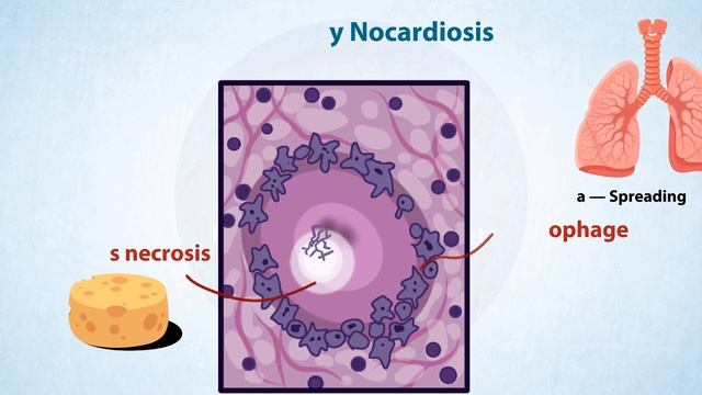 Nocardia: Types, Symptoms, Pathogenicity And Diagnostic Techniques | Bacteriology