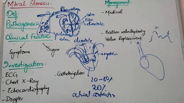CVS MEDICINE lecture 15 MITRAL STENOSIS with scenario and all basic cocepts in detail and easy way смотреть онлайн