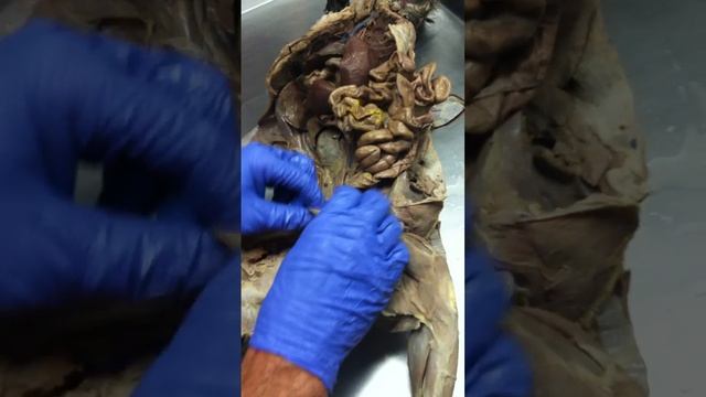 anatomy 224 male reproductive sys смотреть онлайн