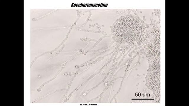 Saccharomycotina смотреть онлайн