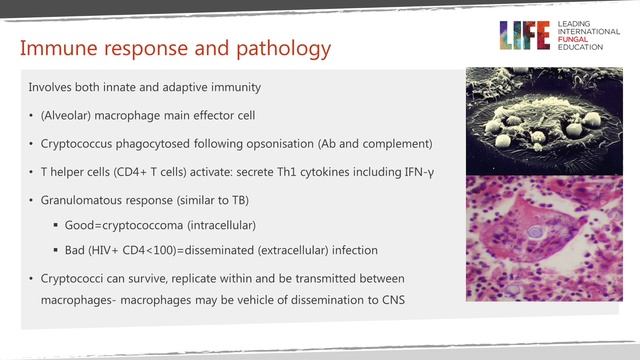 Cryptococcal meningitis: pathogenesis and host response смотреть онлайн