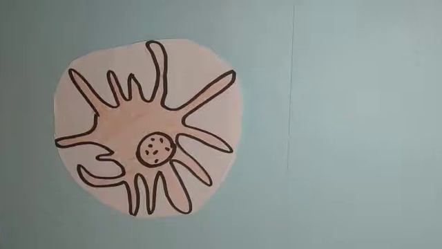 Histocompatibilidad Candida  Albicans