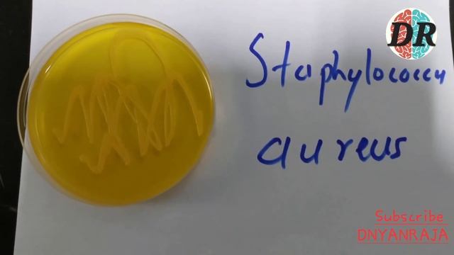 ESCHERICHIA COLI, PSEDOMONAS AERUGINOSA, STAPHYLOCOCCUS AUREUS AND CANDIDA ALBICANS