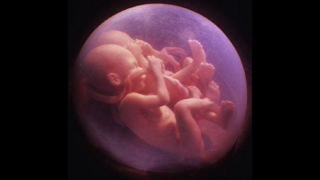 twins/ близнецы смотреть онлайн