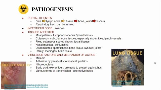 Sporotrichosis смотреть онлайн