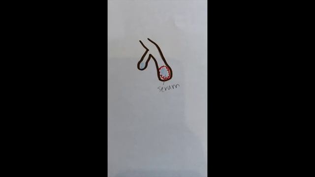 Microbiology Bio2561k смотреть онлайн