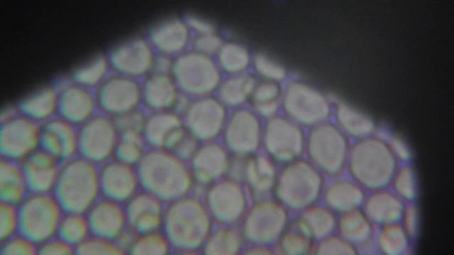 Saccharomyces Cerevisiae (baker's Yeast) Under My Microscope
