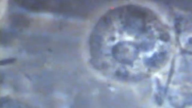 Spirochetes and Trichomonas at 5,000X William D Nordquist смотреть онлайн