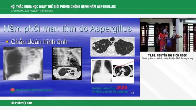 VILA-Tiếp cận chẩn đoán bệnh Nấm phổi do Aspergillus смотреть онлайн