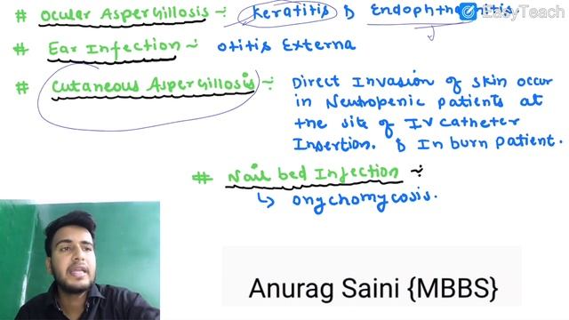 Aspergillosis Microbiology//morphology//pathogenesis//lab-diagnosis//Treatment