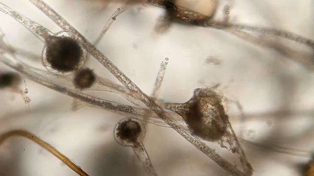 Tempeh - Rhizopus Oligosporus Seen Through The Microscope