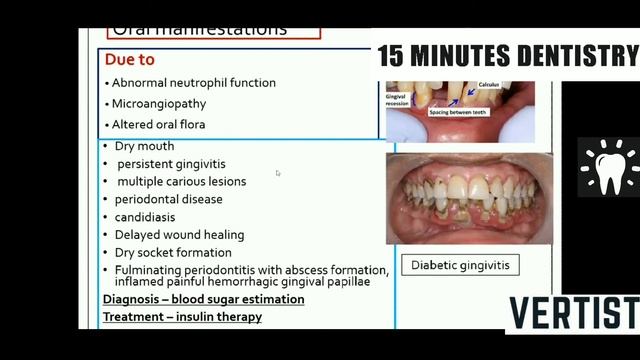 Type Of Aphthous Ulcer | Disturbance In Mineral | Vitamin | Protein | Carbohydrates | Lipid