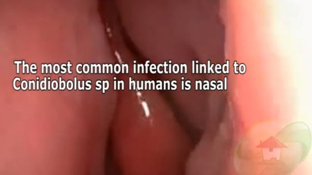 Conidiobolus Sp