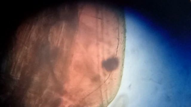 Blood Worms 🪱Heart Beat 💓 under Microscope 🔬- | Glycera species смотреть онлайн
