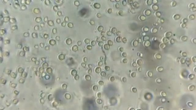Observation de cellules de levure Saccharomyces cerevisiae 360p смотреть онлайн