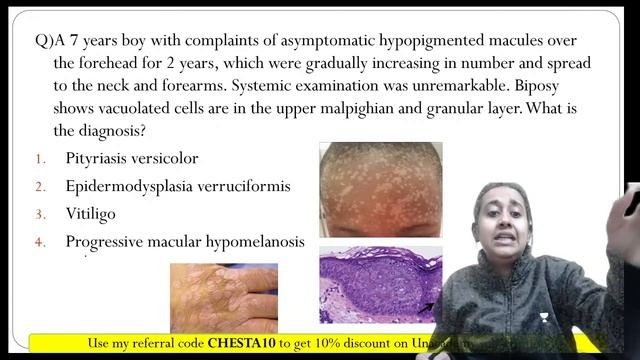 Highly Expected MCQs from Dermatology | NEET PG 2021 | Dr. Chesta Agarwal смотреть онлайн