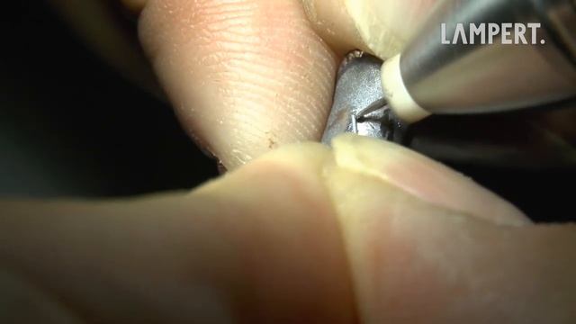 PUK dental welding - crown hole смотреть онлайн