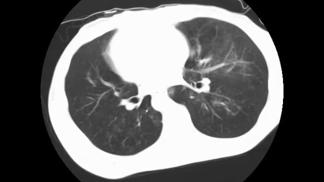 PCP (Ahuja AT et al; 2017) Book: Essential Radiology смотреть онлайн