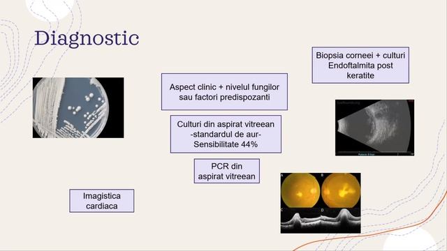Uveitis part 2 Yanoff Workshop смотреть онлайн