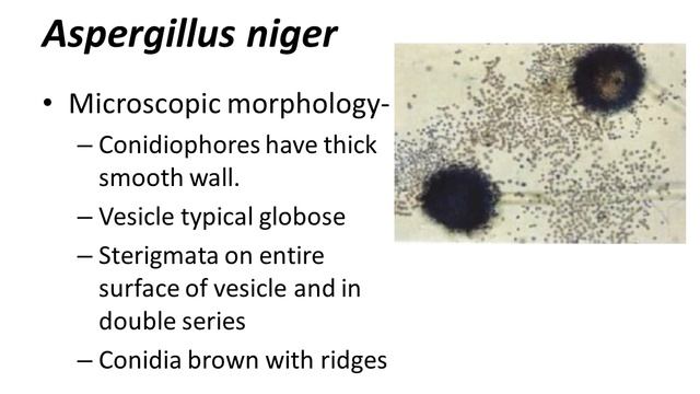 Aspergillus species смотреть онлайн