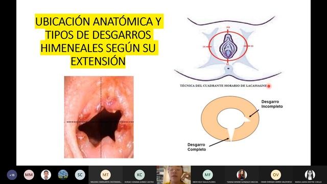 SEMANA 3 - SEXOLOGÍA FORENSE - MEDICINA LEGAL - 13/03/2022 смотреть онлайн