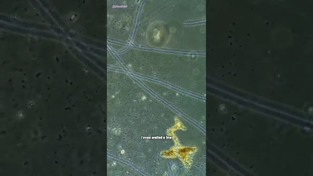 Old Penicillin vs Germs Under Microscope смотреть онлайн