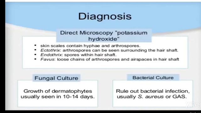 Tinea capitis treatment, tinea capitis treatment fluconazole, tinea capitis causes, Tinea Capitis смотреть онлайн