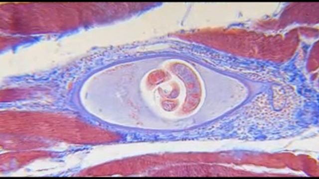 Hunting - food safety for hunters (part 2 of 2) смотреть онлайн