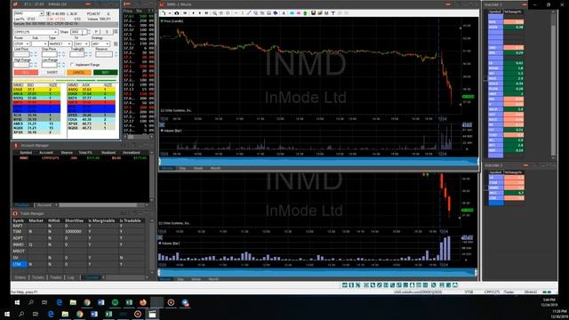 Tape Reading - $INMD (Ru Comments)