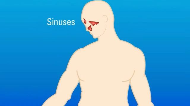 Extrapulmonary Aspergillosis – Type Of Fungal Infection