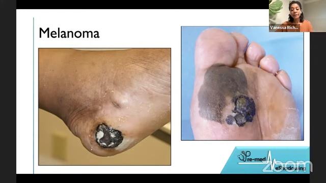 Pre-med eShadowing - Vanessa Richardson, MD (Dermatology) смотреть онлайн