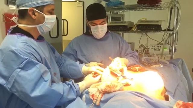 Can You Fix A Tummy Tuck Scar смотреть онлайн