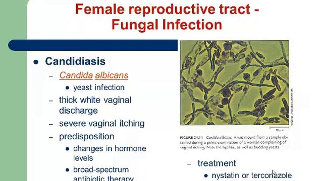 Biol 211Audio Lesson 15 Genitourinary Infections Part 3 смотреть онлайн