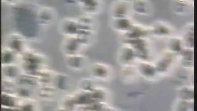 06 Candida albicans 1 смотреть онлайн