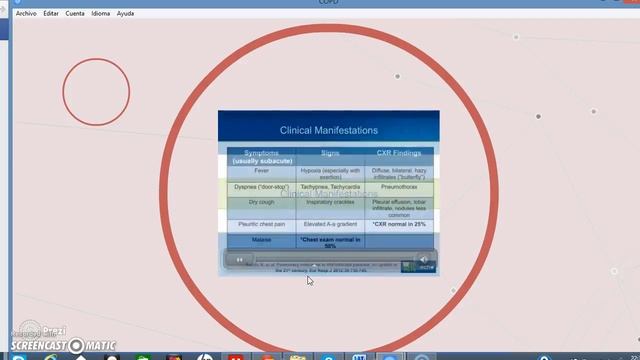 HIV INFECTION WITH AIDS AND PNEUMOCYSTIS PNEUMONIA PART 3 смотреть онлайн