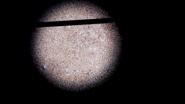 Dirofilaria immitis смотреть онлайн