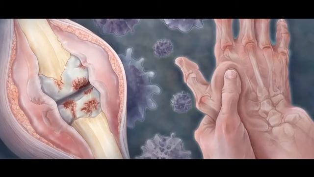 FOHOW Биоэнергомасажер БЭМ (Рекламный ролик) смотреть онлайн